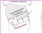 Hvordan man bærer en postpartum bandage og hvordan man tager den korrekt på