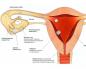 Bagaimana untuk mengetahui bila ovulasi bermula?